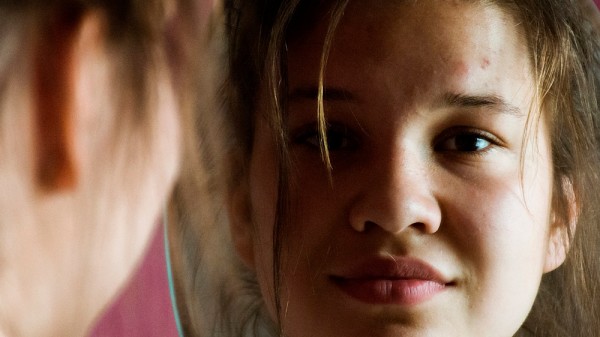 Por qué me salen puntos negros en la nariz, ¿cómo eliminarlos?