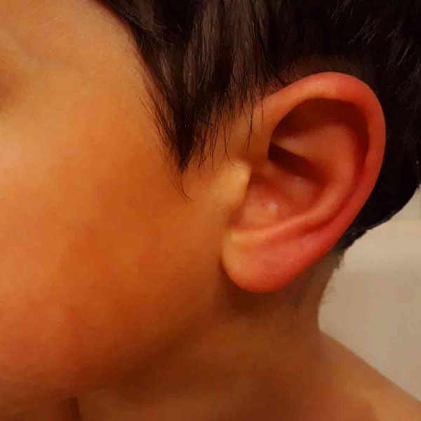 Por qué tengo las orejas rojas y calientes