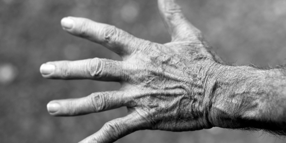 manos arrugadas