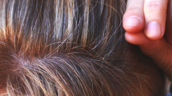 Qué hacer cuando las canas aparecen demasiado pronto. ¿Cabello blanco a los 20 o a los 30 años?