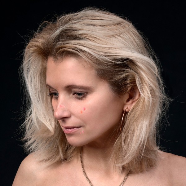 Cómo acabar con el acné en la menopausia