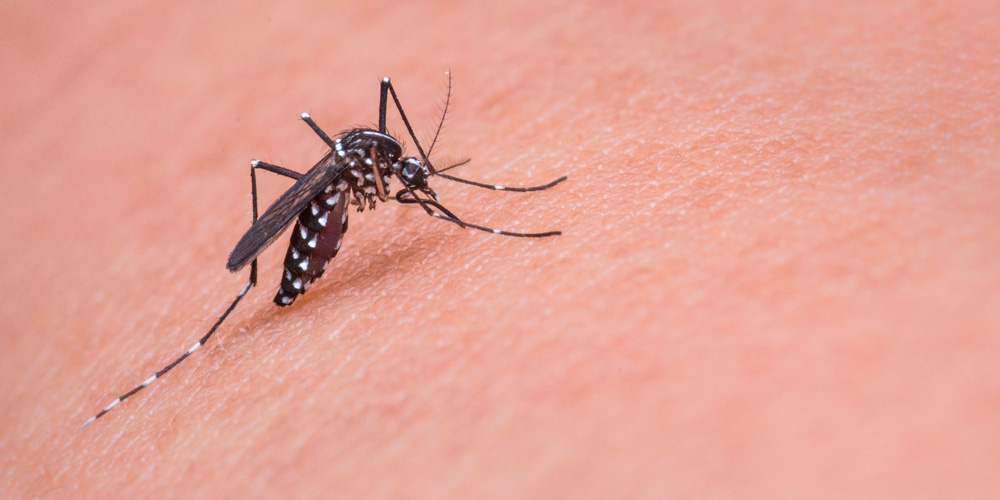 aliviar la picadura de mosquito