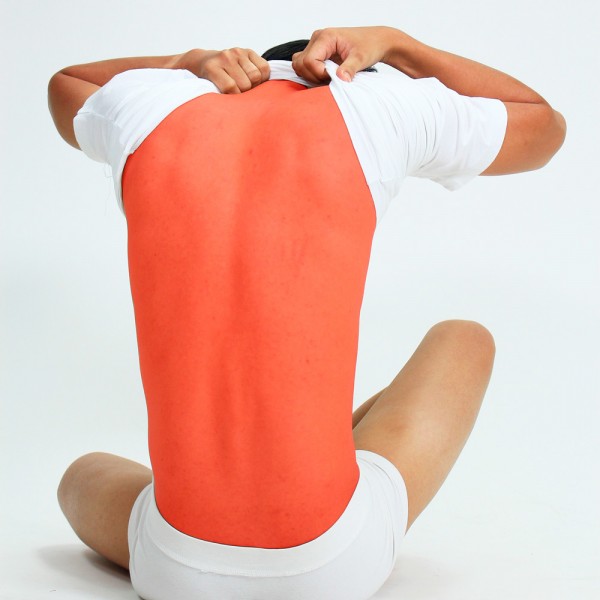 Cómo cuidar las quemaduras del sol: trucos para aliviar la molestia en la piel