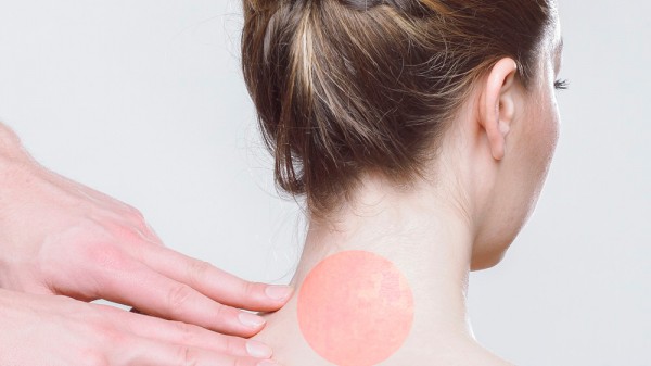 Cómo aliviar el dolor de cuello: remedios caseros y ejercicios