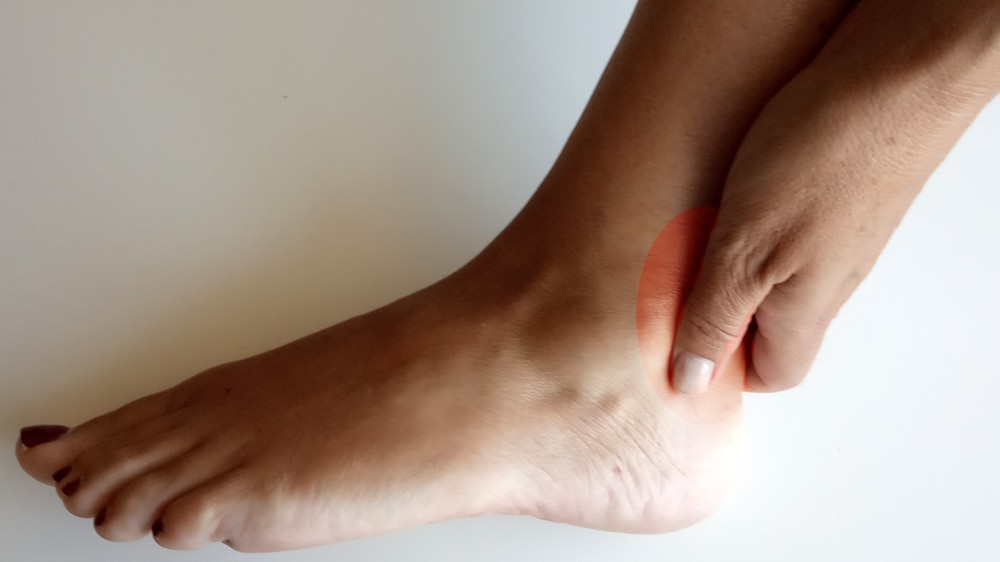 Por qué me duele el talón de Aquiles tendinitis aquilea