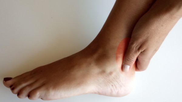 Por qué me duele el talón de Aquiles: tendinitis aquilea