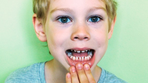 Por qué me salen tantas llagas en la boca