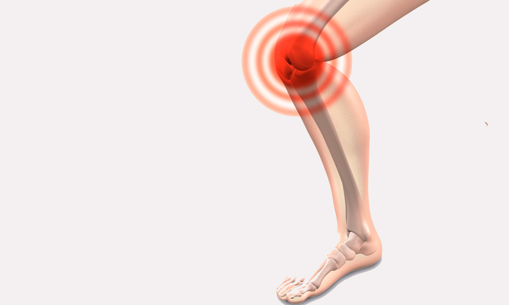 diferencias entre la artrosis y la artritis
