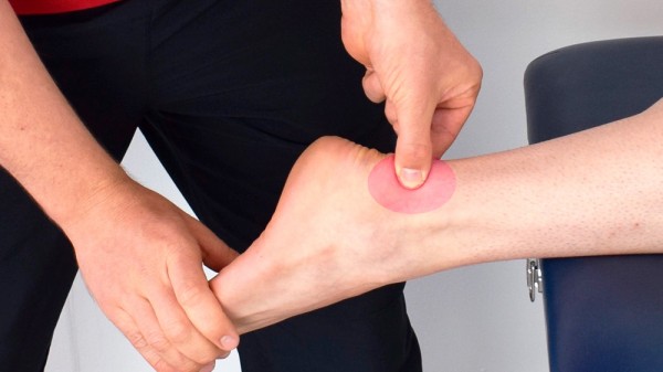 Qué hacer ante una torcedura de tobillo o esguince