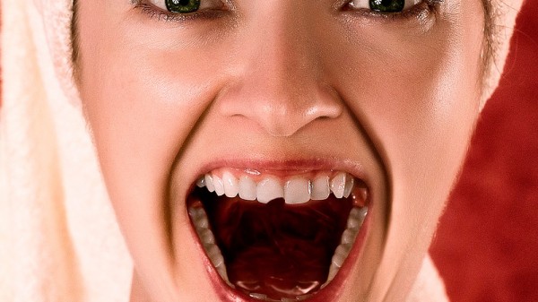 Qué hacer si se rompe un diente definitivo