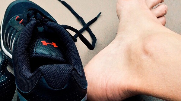 Cómo aliviar el dolor de los juanetes