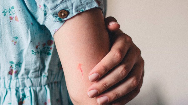 Cómo reducir la apariencia de una cicatriz