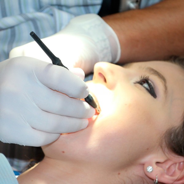 Qué es un curetaje dental y cómo se realiza