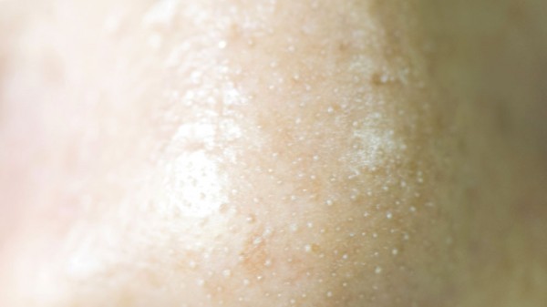 Por qué tengo puntos blancos en la nariz y cómo puedo eliminarlos