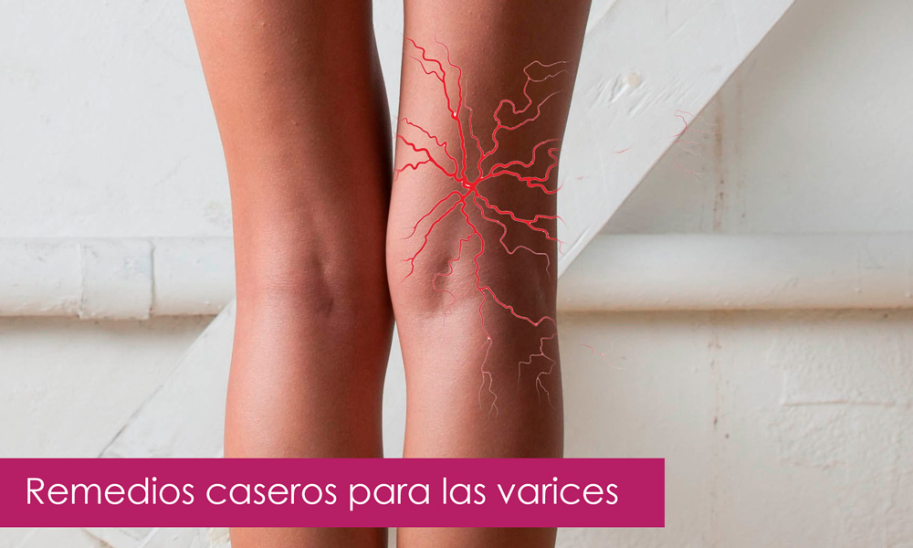Manejo del edema cerebral pdf