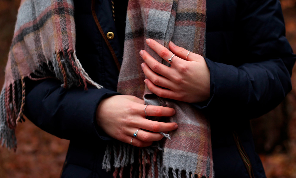 como tratar los sabañones