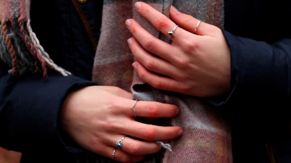 Cómo curar los sabañones con remedios caseros