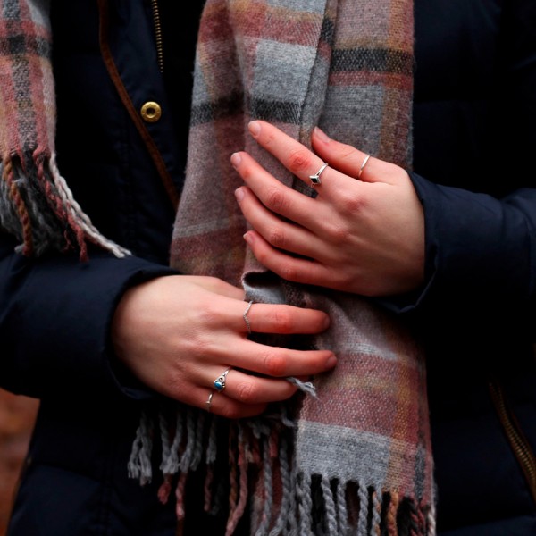 Cómo curar los sabañones con remedios caseros