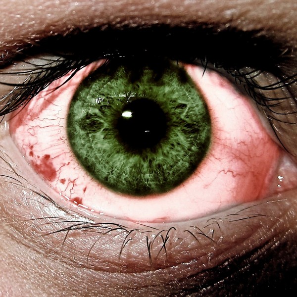 Ojos rojos: ¿cuáles son las causas y qué remedios pueden tratarlos?