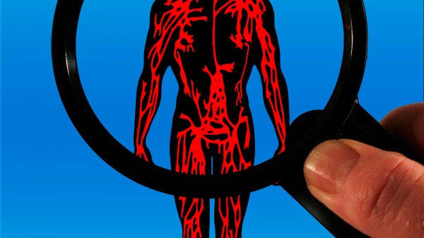 ¿Qué es la sepsis? Síntomas, causas y tratamiento