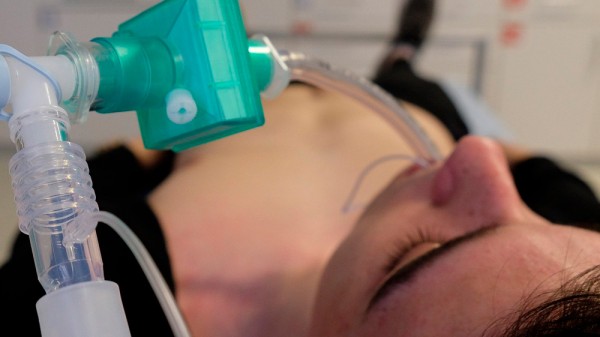 Qué es una intubación endotraqueal y para qué sirve