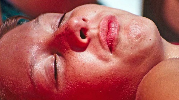 Cómo diferenciar la alergia solar de una quemadura del sol