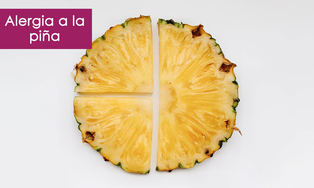 alergia a la piña
