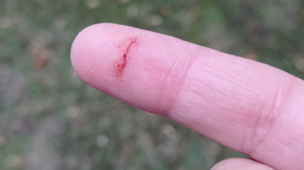 Corte en el dedo con papel: ¿por qué duele tanto?