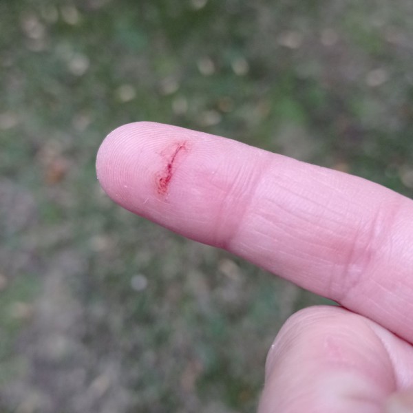 Corte en el dedo con papel: ¿por qué duele tanto?
