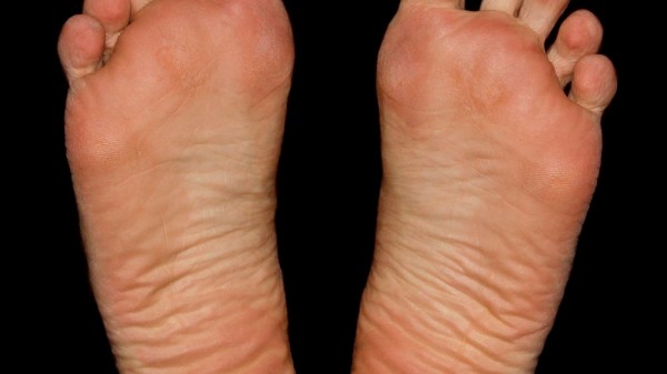 Cómo hidratar los pies secos y con durezas