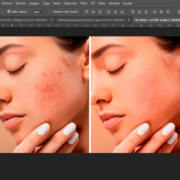 Cómo eliminar granos e imperfecciones con Phosothop (¡muy fácil!)