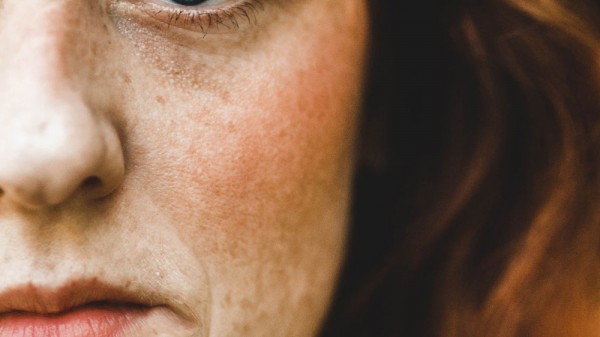 Boca hacia abajo: ¿cómo elevar la comisura de los labios?