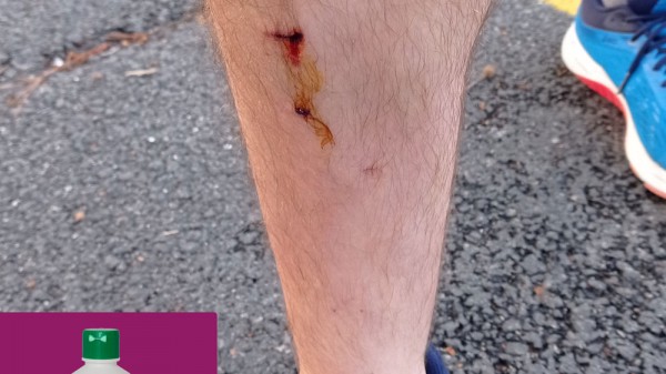 ¿Se debe echar agua oxigenada en una herida?