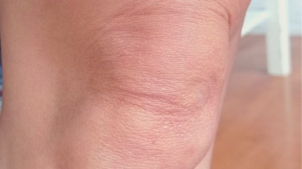 Cómo prevenir las arrugas en las rodillas (y tratamientos para eliminarlas)