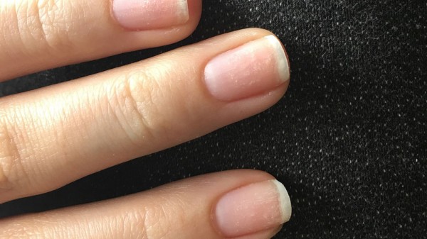 Qué hacer si tengo las uñas frágiles. Soluciones para uñas partidas