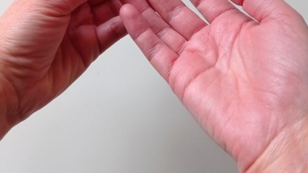 Cómo sacar una astilla de la piel (trucos útiles cuando las pinzas fallan)