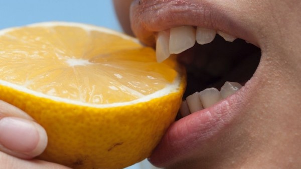 Qué alimentos tiñen los dientes y qué hacer para blanquearlos