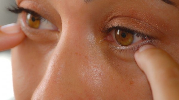 Blefaroplastia inferior: Cosas que no te han contado