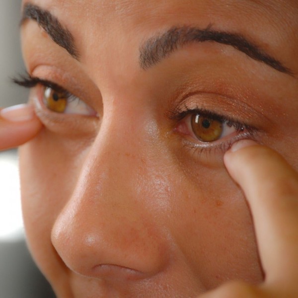 Blefaroplastia inferior: Cosas que no te han contado