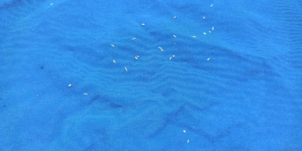 Así son las lombrices intestinales