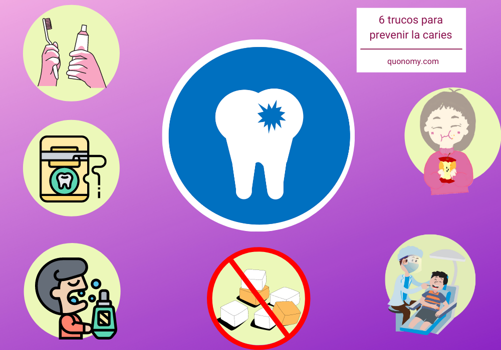 trucos para prevenir la aparición de caries