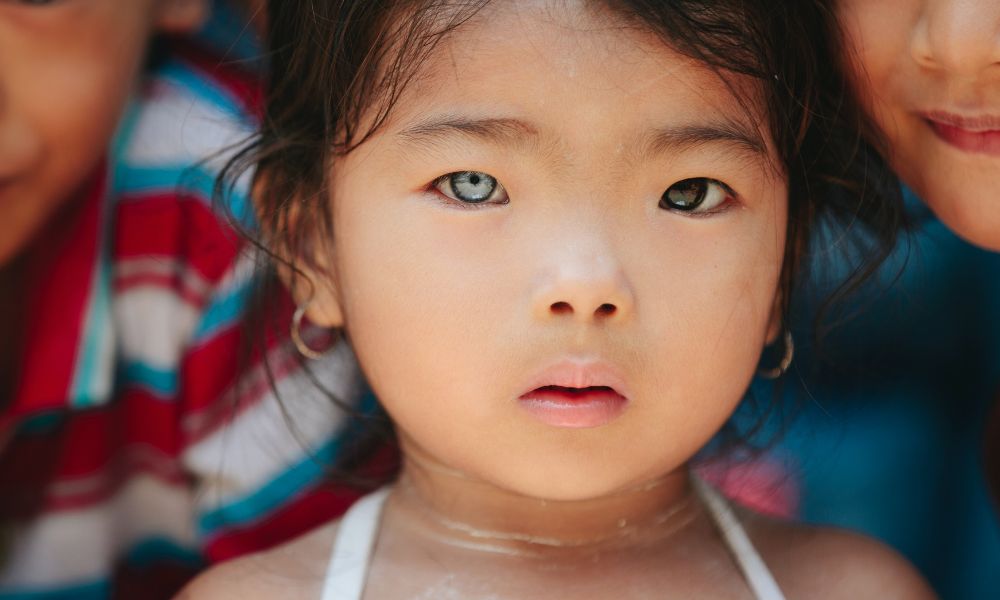 Ojos de distinto color