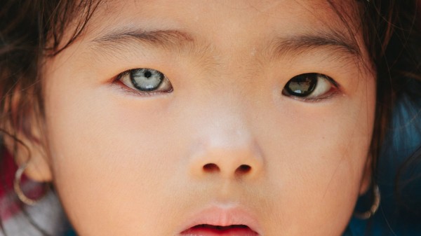 Tener ojos de distinto color o la heterocromía del iris: ¿por qué sucede?