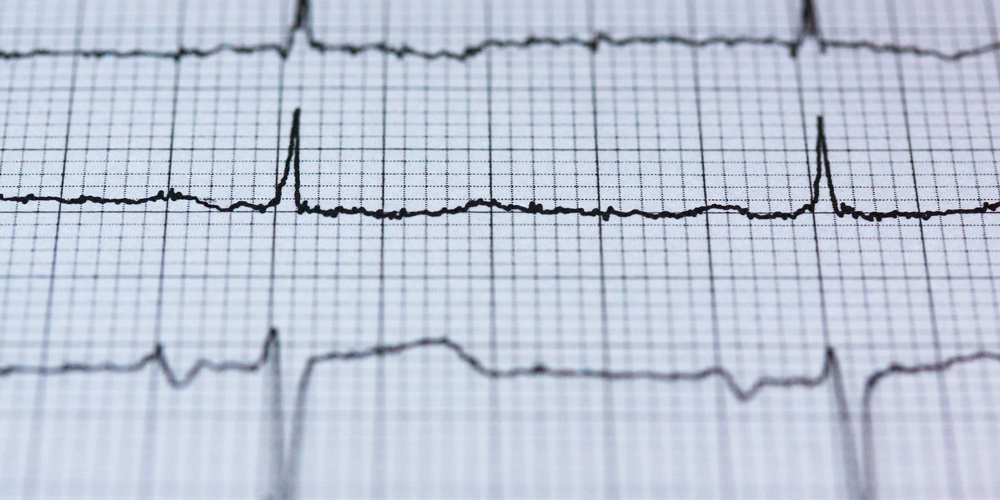 ¿Funciona realmente el polígrafo?